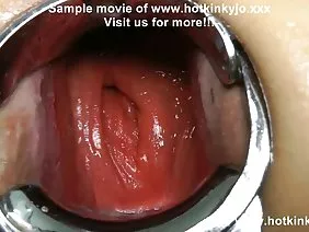 এশিয়ান লিঙ্গের ডায় ...